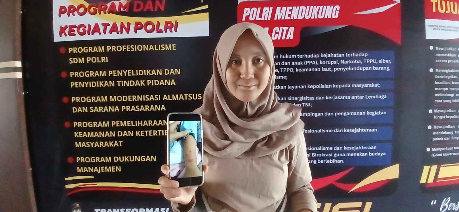 Daycare di Yogyakarta Diduga Aniaya Anak, Orang Tua Laporkan ke Polisi