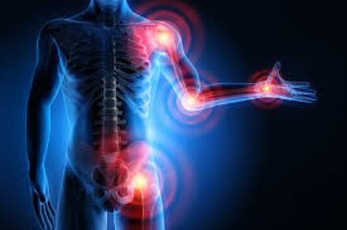 Kenali Penyebab dan Pencegahan Pada Nyeri Sendi ‘Osteoarthritis’