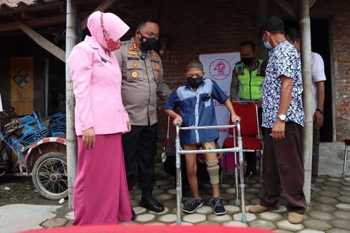 Kiki, Bocah Penyandang Disabilitas Dapat Santunan Kaki Palsu dari Polres Demak